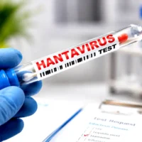 Hantavirus test