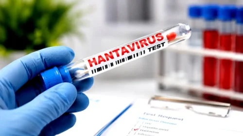 Hantavirus test
